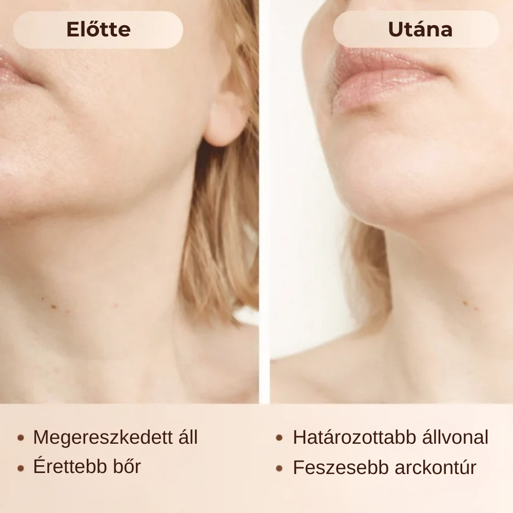 Nyirokáramlást Serkentő Arckefe - Burelin™
