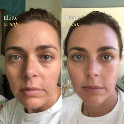 Nyirokáramlást Serkentő Arckefe - Burelin™